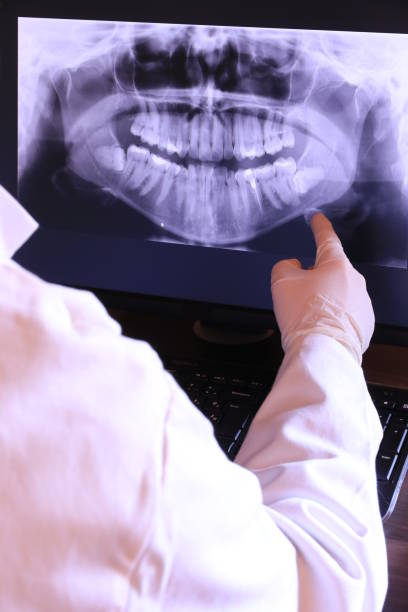 Best Emergency Dentist for Knocked-Out Tooth in Marquette, MI