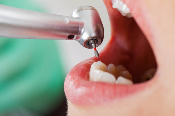 Best Emergency Cosmetic Dentistry in Marquette, MI
